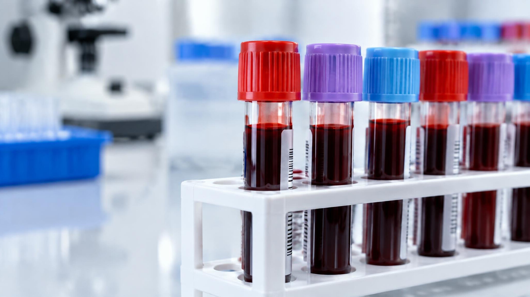 Laboratory test tubes and blood samples on a rack